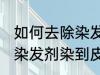 如何去除染发剂染在皮肤上的颜色 被染发剂染到皮肤如何处理